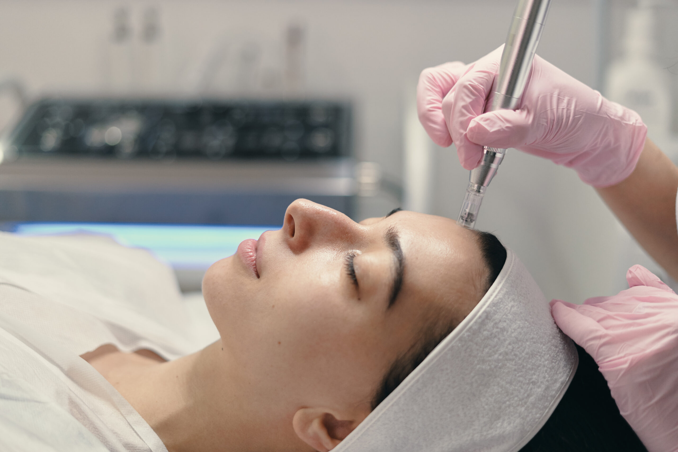 Microneedling with Dermapen and its benefits for the skin